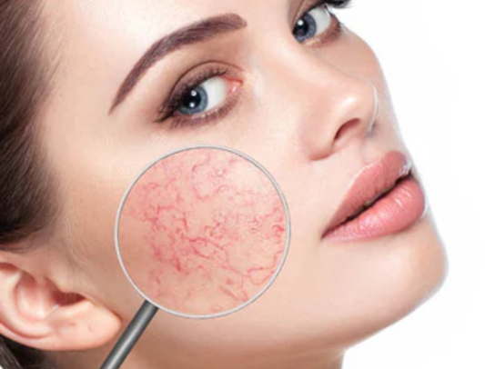 The Best Skin Care Products for Sensitive Skin in Pakistan