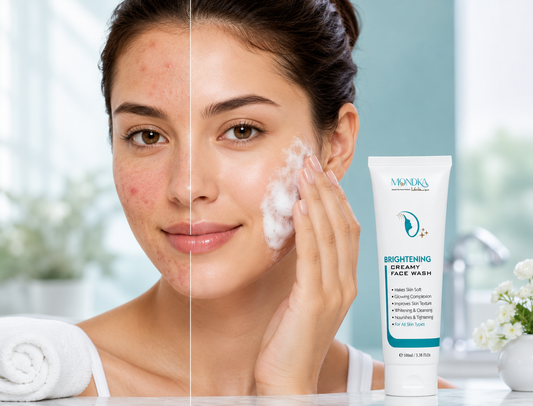 The Best Face Wash for Acne in Pakistan — Meet Mondka
